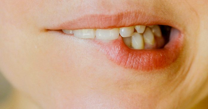 How long do cold sores last?